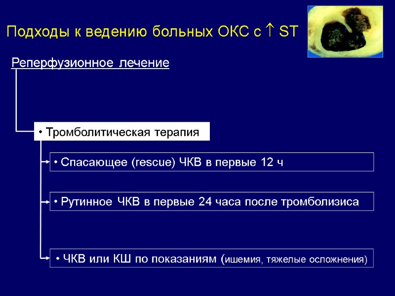 Реперфузионное лечение  Тромболитическая терапия  Спасающее (rescue) ЧКВ в первые 12 ч 